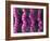 Irritable Bowel Syndrome-David Mack-Framed Photographic Print