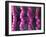 Irritable Bowel Syndrome-David Mack-Framed Photographic Print