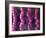 Irritable Bowel Syndrome-David Mack-Framed Photographic Print