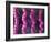 Irritable Bowel Syndrome-David Mack-Framed Photographic Print