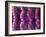 Irritable Bowel Syndrome-David Mack-Framed Photographic Print