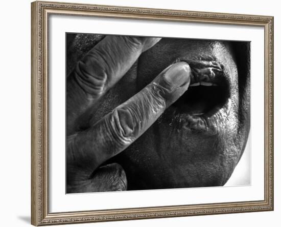 Jazz Trumpeter Louis Armstrong Massaging Lips with Balm to Keep Them Strong for Playing His Trumpet-John Loengard-Framed Premium Photographic Print