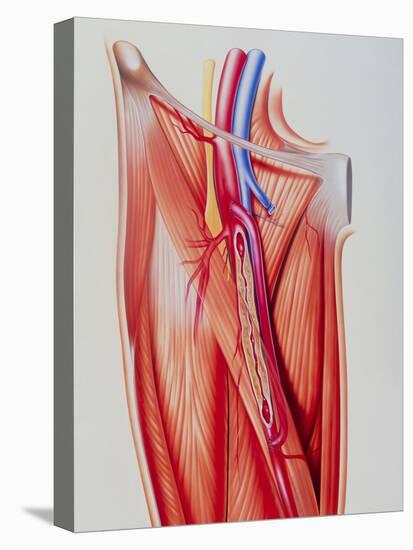 Stretched Canvas Print, , large