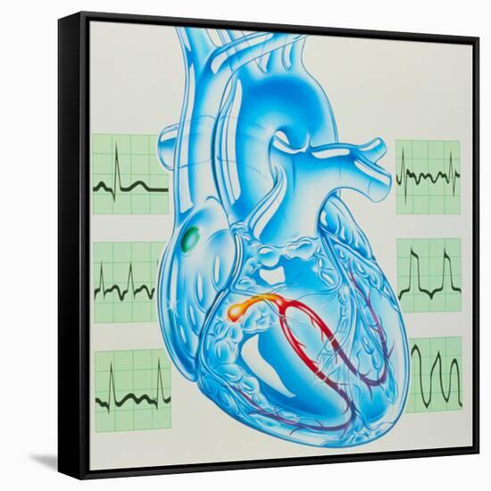 Stretched Canvas Print, , large