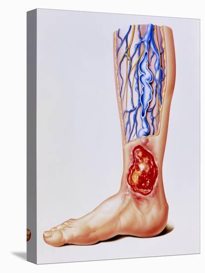 Stretched Canvas Print, , large