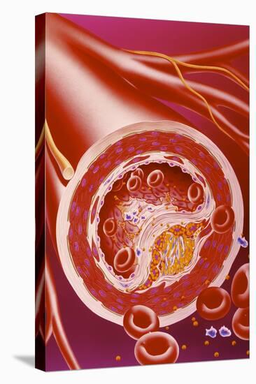 Stretched Canvas Print, , large
