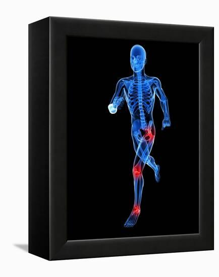 Joint Pain, Conceptual Artwork-SCIEPRO-Framed Premier Image Canvas