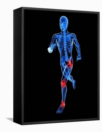 Joint Pain, Conceptual Artwork-SCIEPRO-Framed Premier Image Canvas