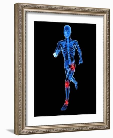 Joint Pain, Conceptual Artwork-SCIEPRO-Framed Photographic Print