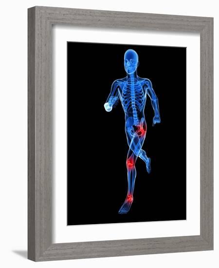 Joint Pain, Conceptual Artwork-SCIEPRO-Framed Photographic Print