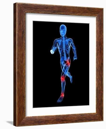 Joint Pain, Conceptual Artwork-SCIEPRO-Framed Photographic Print