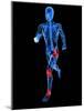 Joint Pain, Conceptual Artwork-SCIEPRO-Mounted Photographic Print