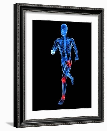 Joint Pain, Conceptual Artwork-SCIEPRO-Framed Photographic Print