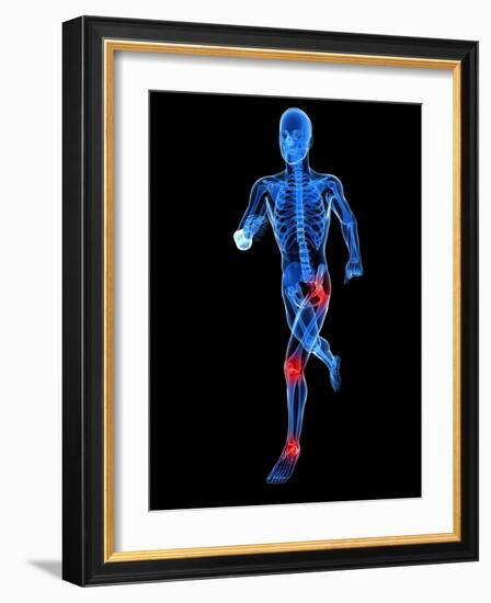 Joint Pain, Conceptual Artwork-SCIEPRO-Framed Photographic Print