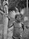 Malformation of the Ears, Solomon Islands, 1920-JW Beattie-Framed Premier Image Canvas