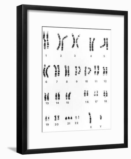 Karyotype of Chromosomes In Down's Syndrome-L. Willatt-Framed Photographic Print
