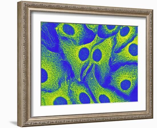 Keratinocyte Skin Cells, Light Micrograph-Science Photo Library-Framed Photographic Print