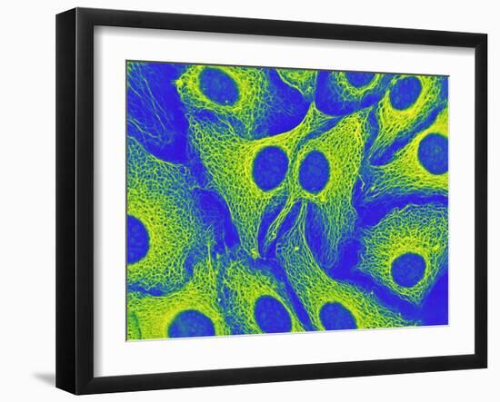 Keratinocyte Skin Cells, Light Micrograph-Science Photo Library-Framed Photographic Print