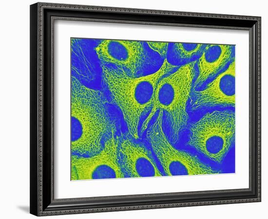 Keratinocyte Skin Cells, Light Micrograph-Science Photo Library-Framed Photographic Print