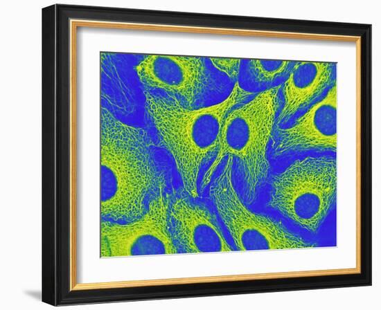 Keratinocyte Skin Cells, Light Micrograph-Science Photo Library-Framed Photographic Print