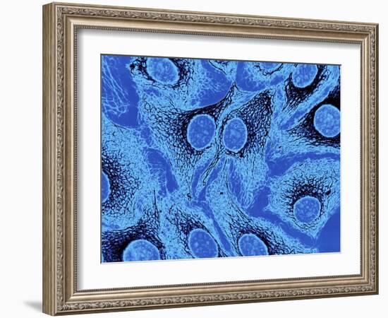 Keratinocyte Skin Cells, Light Micrograph-Science Photo Library-Framed Photographic Print