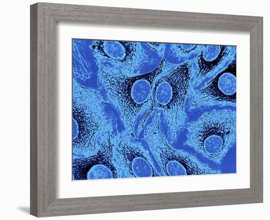 Keratinocyte Skin Cells, Light Micrograph-Science Photo Library-Framed Photographic Print