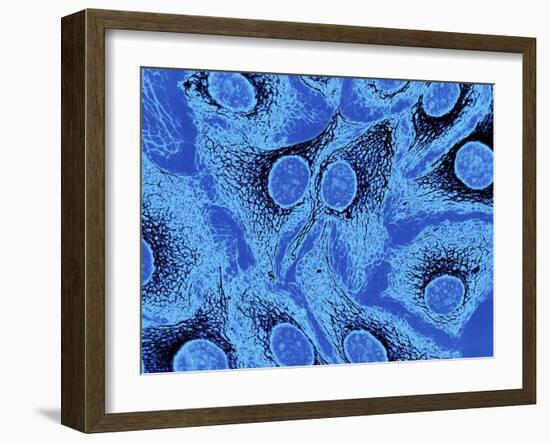 Keratinocyte Skin Cells, Light Micrograph-Science Photo Library-Framed Photographic Print