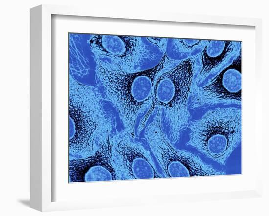 Keratinocyte Skin Cells, Light Micrograph-Science Photo Library-Framed Photographic Print