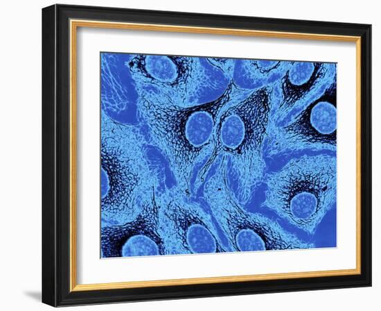 Keratinocyte Skin Cells, Light Micrograph-Science Photo Library-Framed Photographic Print