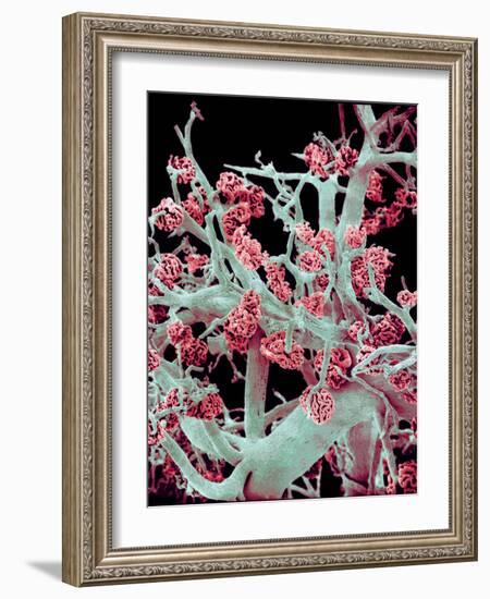 Kidney Blood Vessels, SEM-Susumu Nishinaga-Framed Photographic Print