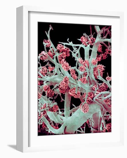 Kidney Blood Vessels, SEM-Susumu Nishinaga-Framed Photographic Print