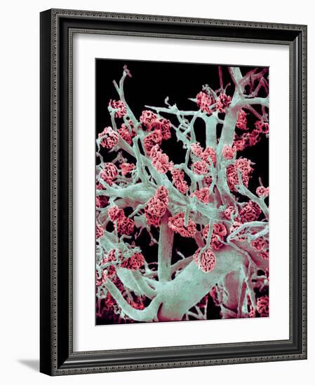 Kidney Blood Vessels, SEM-Susumu Nishinaga-Framed Photographic Print