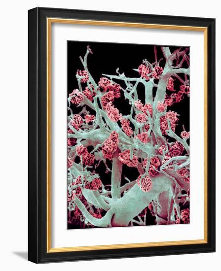 Kidney Blood Vessels, SEM-Susumu Nishinaga-Framed Photographic Print