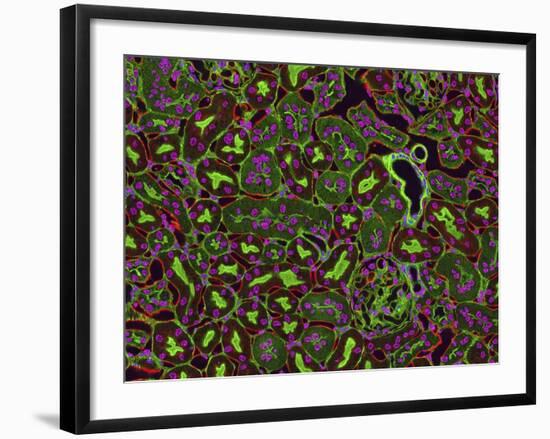 Kidney Cells, Light Micrograph-Thomas Deerinck-Framed Photographic Print