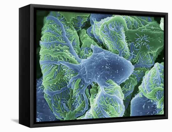 Kidney Glomeruli, SEM-Steve Gschmeissner-Framed Premier Image Canvas