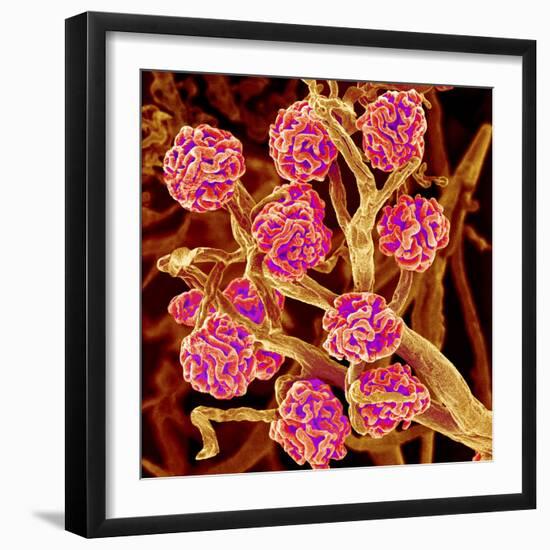 Kidney Glomeruli, SEM-Susumu Nishinaga-Framed Premium Photographic Print