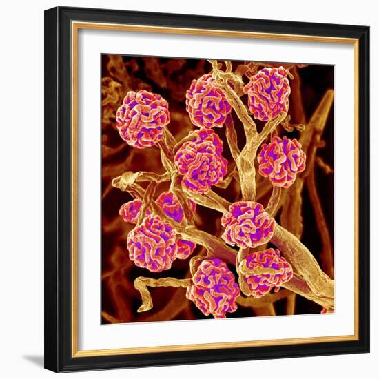 Kidney Glomeruli, SEM-Susumu Nishinaga-Framed Premium Photographic Print