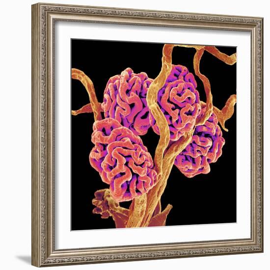 Kidney Glomeruli, SEM-Susumu Nishinaga-Framed Premium Photographic Print