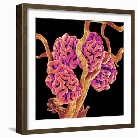 Kidney Glomeruli, SEM-Susumu Nishinaga-Framed Premium Photographic Print