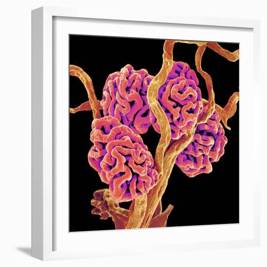 Kidney Glomeruli, SEM-Susumu Nishinaga-Framed Premium Photographic Print