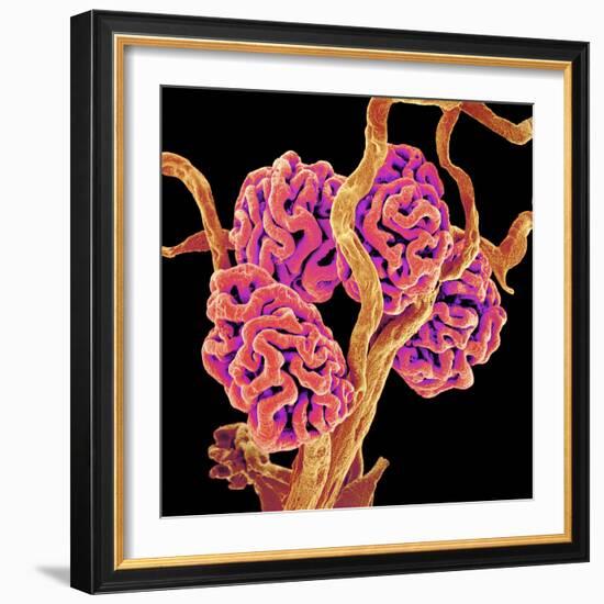 Kidney Glomeruli, SEM-Susumu Nishinaga-Framed Premium Photographic Print