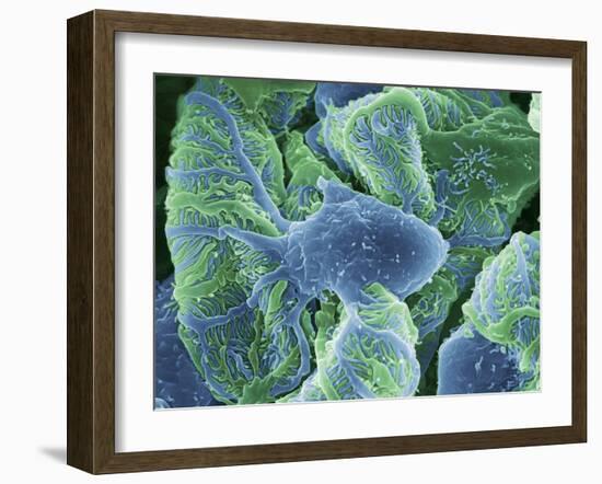 Kidney Glomeruli, SEM-Steve Gschmeissner-Framed Photographic Print