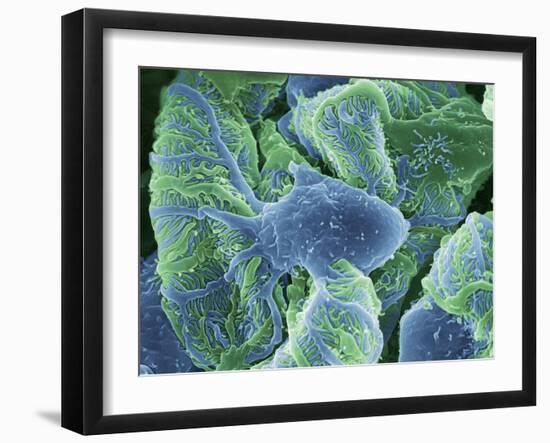 Kidney Glomeruli, SEM-Steve Gschmeissner-Framed Photographic Print