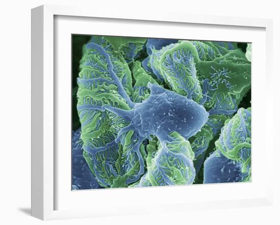 Kidney Glomeruli, SEM-Steve Gschmeissner-Framed Photographic Print