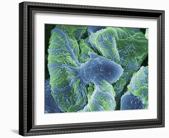 Kidney Glomeruli, SEM-Steve Gschmeissner-Framed Photographic Print