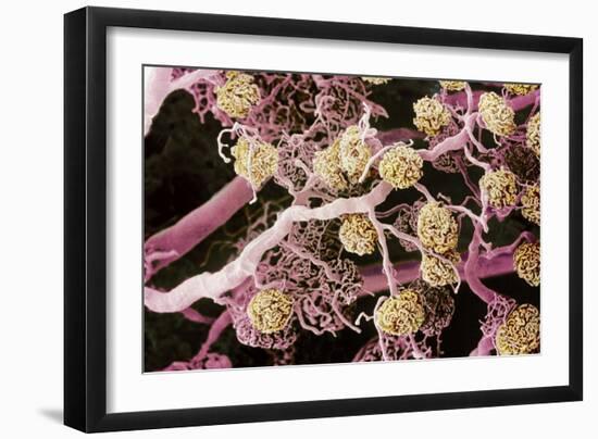 Kidney Glomeruli, SEM-Steve Gschmeissner-Framed Photographic Print