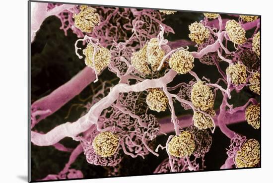 Kidney Glomeruli, SEM-Steve Gschmeissner-Mounted Photographic Print