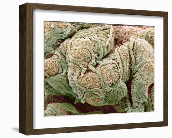 Kidney Glomeruli, SEM-Steve Gschmeissner-Framed Photographic Print