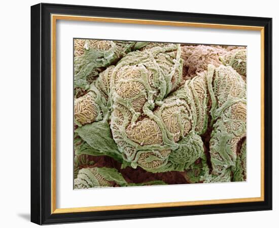 Kidney Glomeruli, SEM-Steve Gschmeissner-Framed Photographic Print