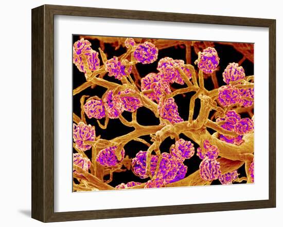 Kidney Glomeruli, SEM-Susumu Nishinaga-Framed Photographic Print